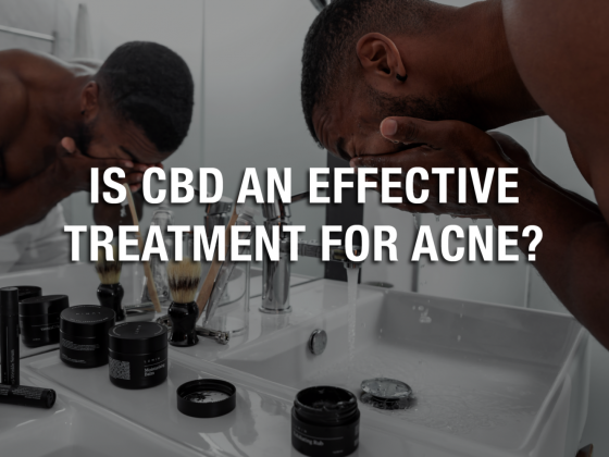 Is CBD an Effective Treatment for Acne?