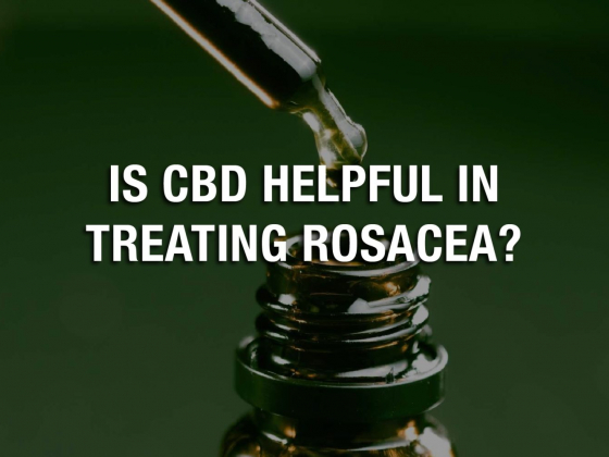 Is CBD Helpful in Treating Rosacea?
