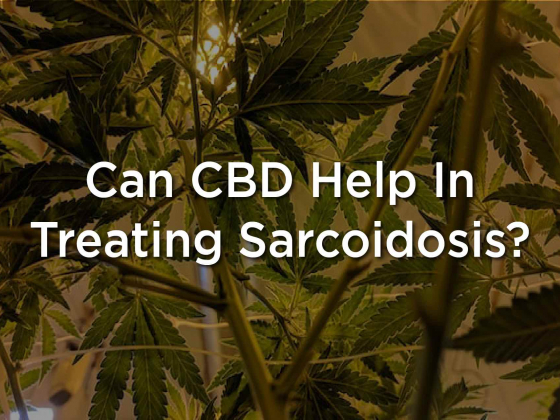 Is CBD Effective In Treating Stage Fright?